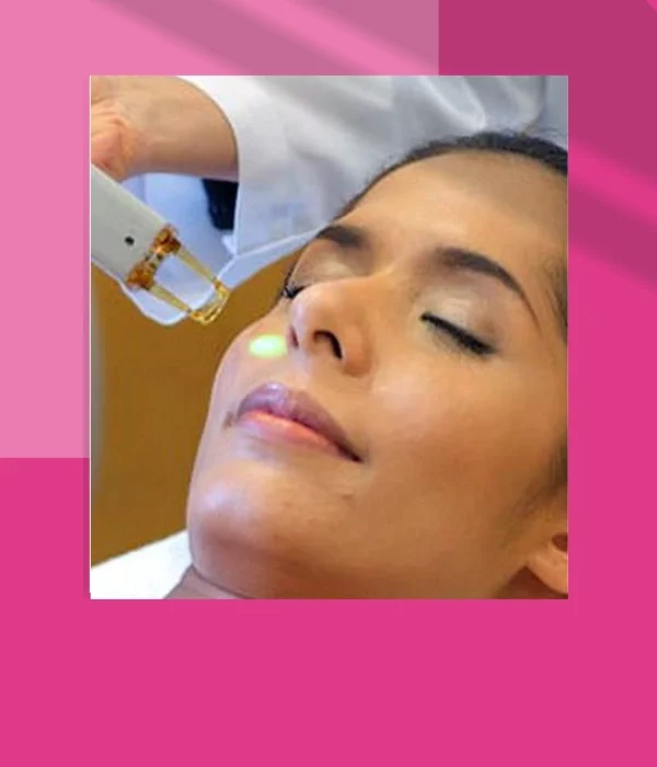 LASER FOR VITILIGO & PSORIASIS
